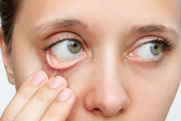 laboratorio-asistencial-hemograma-completo-clinicas-ocupacionales