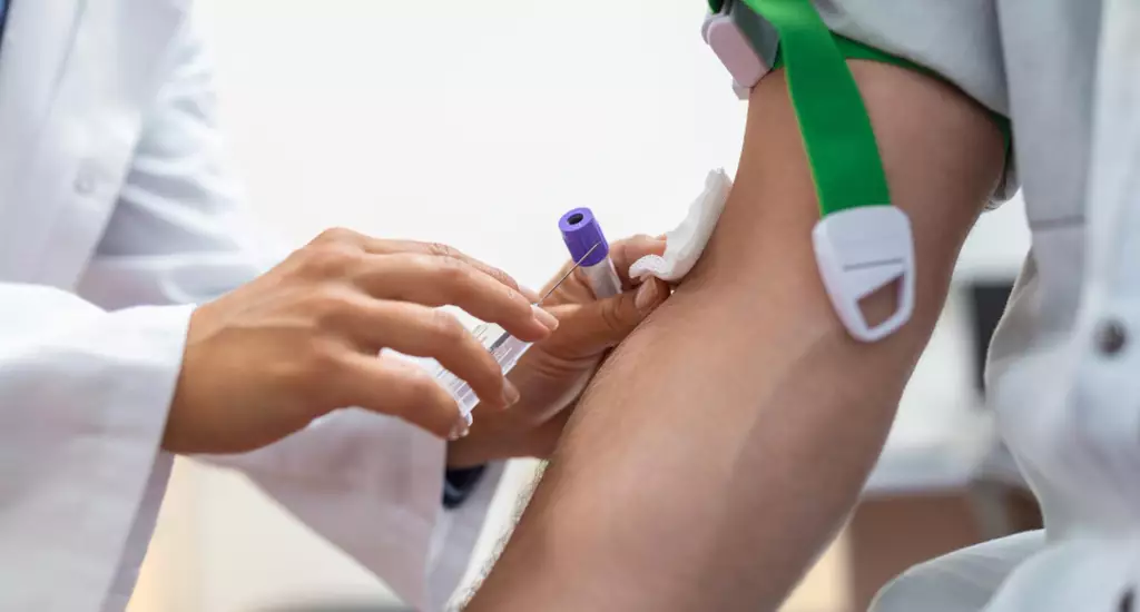 examen de hemoglobina en Lima